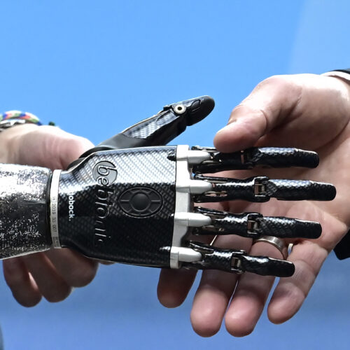 How 3D printing is personalizing health care